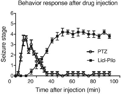 Neural Activities in Multiple Rat Brain Regions in Lithium-Pilocarpine-Induced Status Epilepticus Model